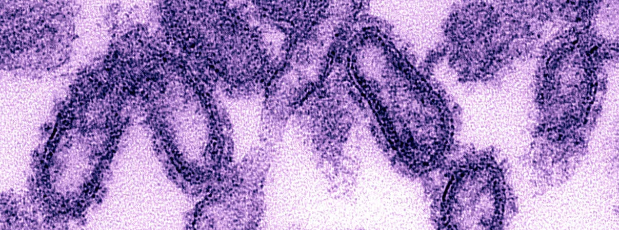 Virus H1N1 - Responsible for the deadly Spanish flu