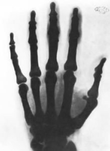 Nikola Tesla X-ray